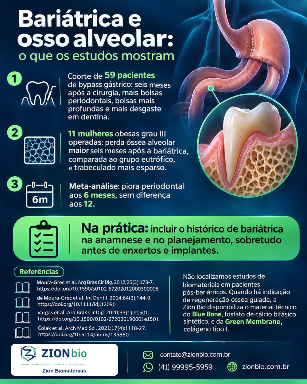 Infográfico: bariátrica e osso alveolar, o que os estudos mostram